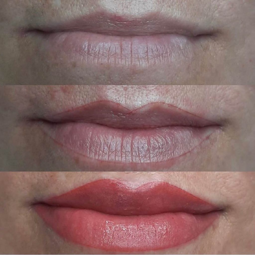 perfilado-de-labios-01