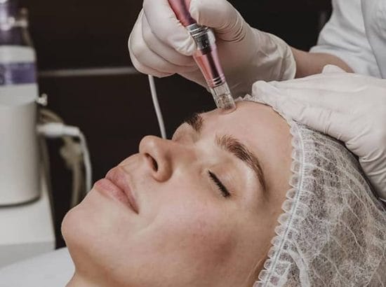 Tratamientos rejuvenecedores Dermapen
