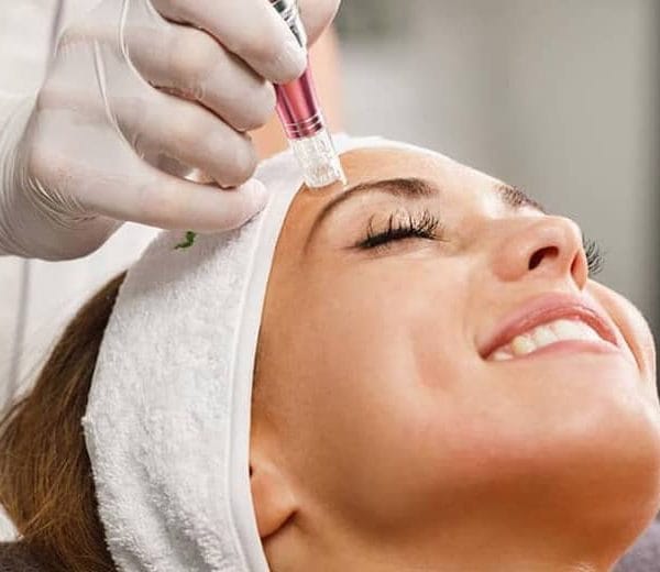 Resultados Tratamientos Dermapen