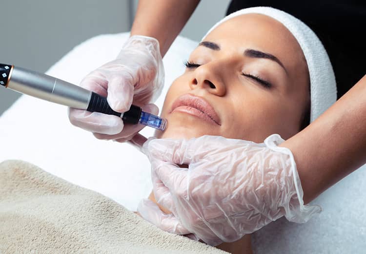 Oferta Dermapen – Tu primera sesión