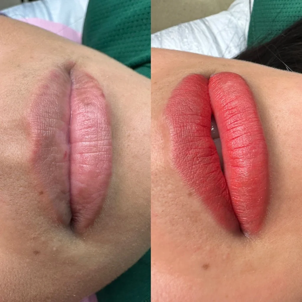 Micropigmentación de labios